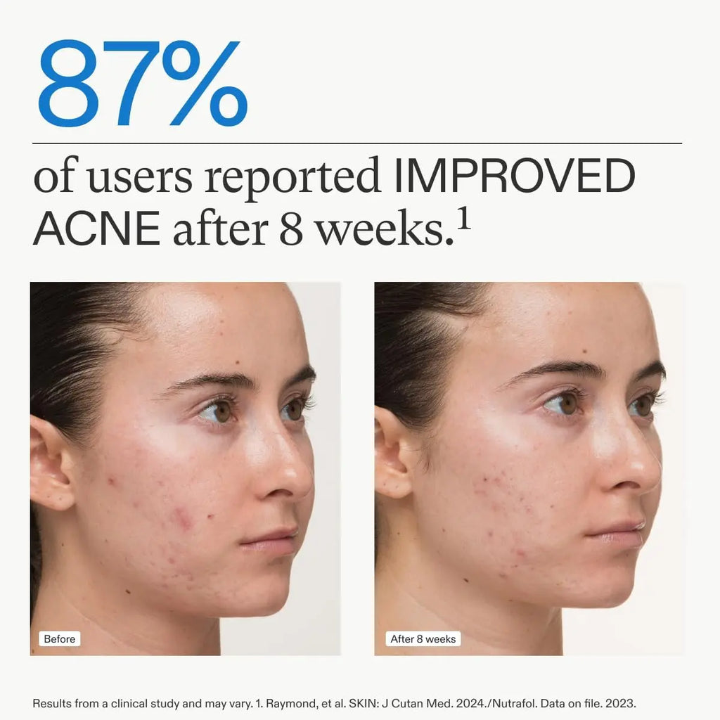 Nutrafol Clear Skin Nutraceutical Acne Supplement 3-Month Supply Nava Beauty